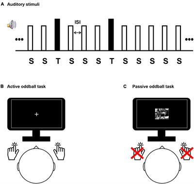 Deep learning-based electroencephalic diagnosis of tinnitus symptom